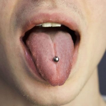 nyelv piercing kezelés