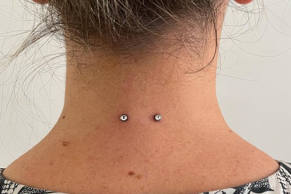 Felületi piercing