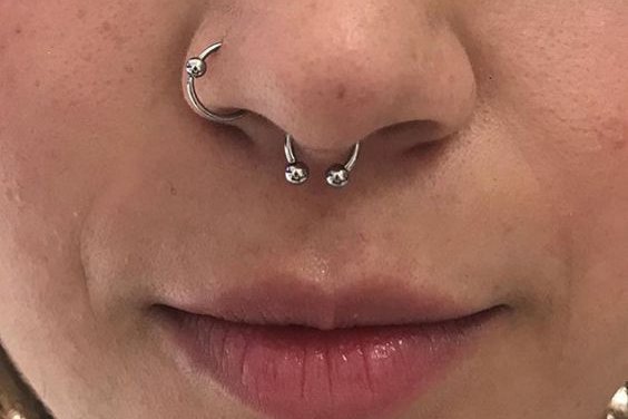 Orr piercing kezelés