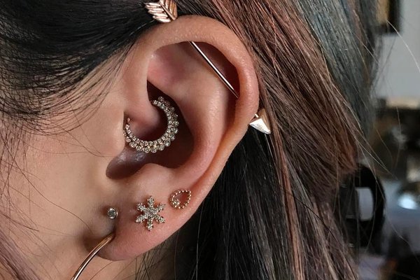 migrén piercing