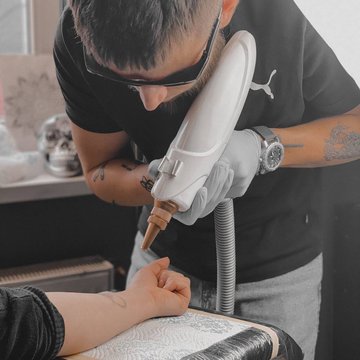 Laser tattoo removal in Györ