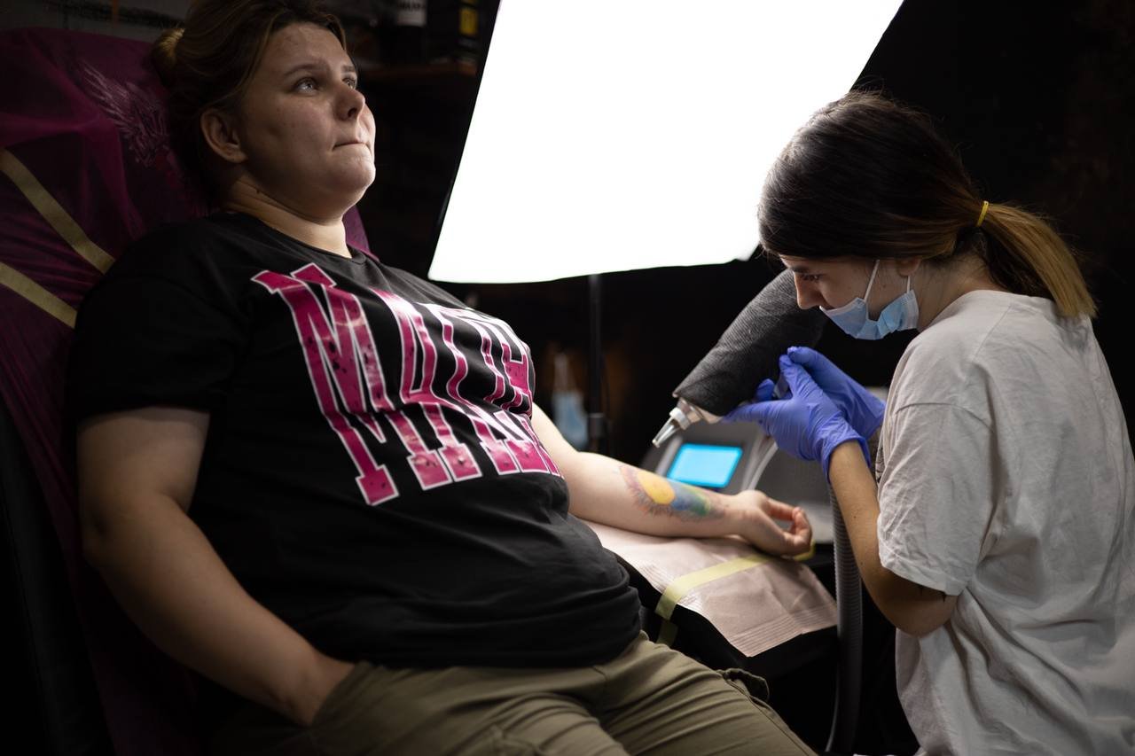 Laser tattoo removal in Szeged