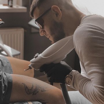 Laser tattoo removal in Györ