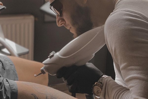 Laser tattoo removal in Szeged