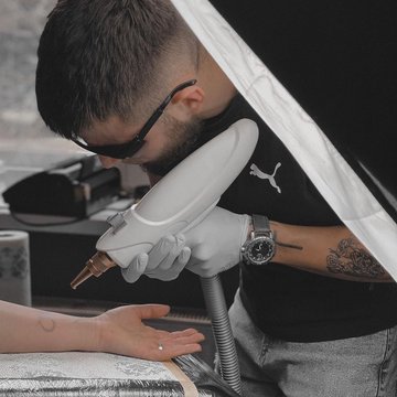 Laser tattoo removal in Györ