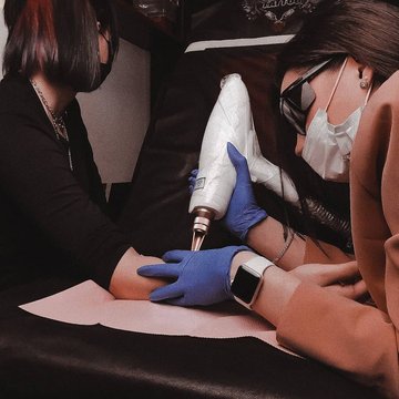 Laser tattoo removal in Debrecen