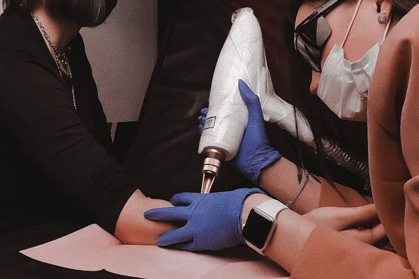 Laser tattoo removal treatments in Budapest