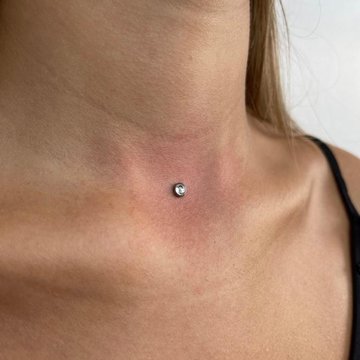 Nyak piercing kezelés