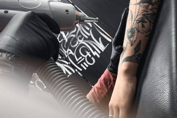 Laser tattoo removal in Budapest