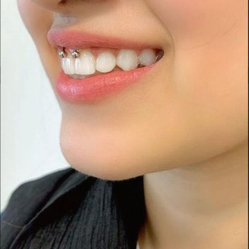 mosoly piercing