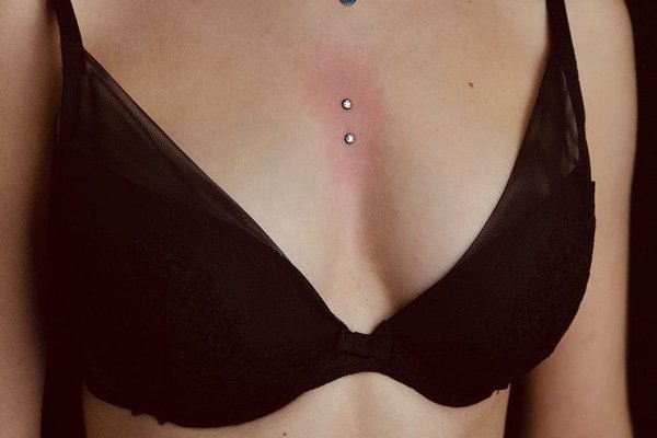 Nyak piercing kezelés