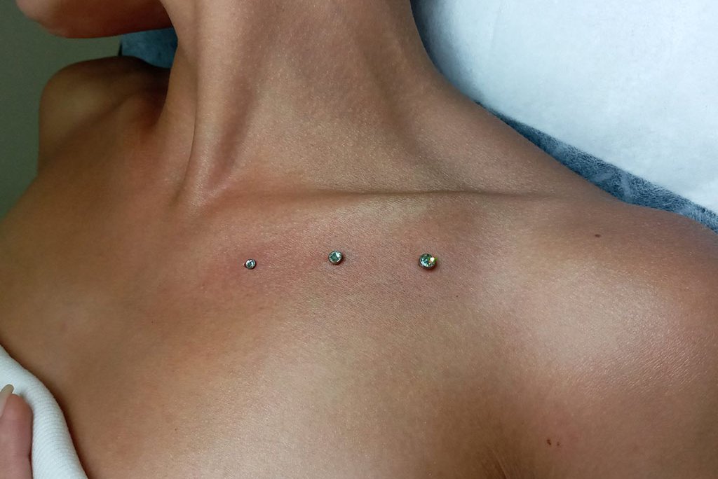 Nyak piercing kezelés